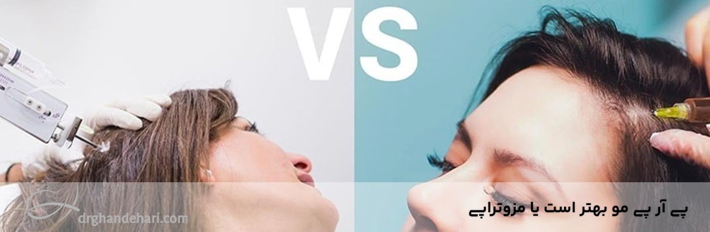 پی آر پی مو بهتر است یا مزوتراپی