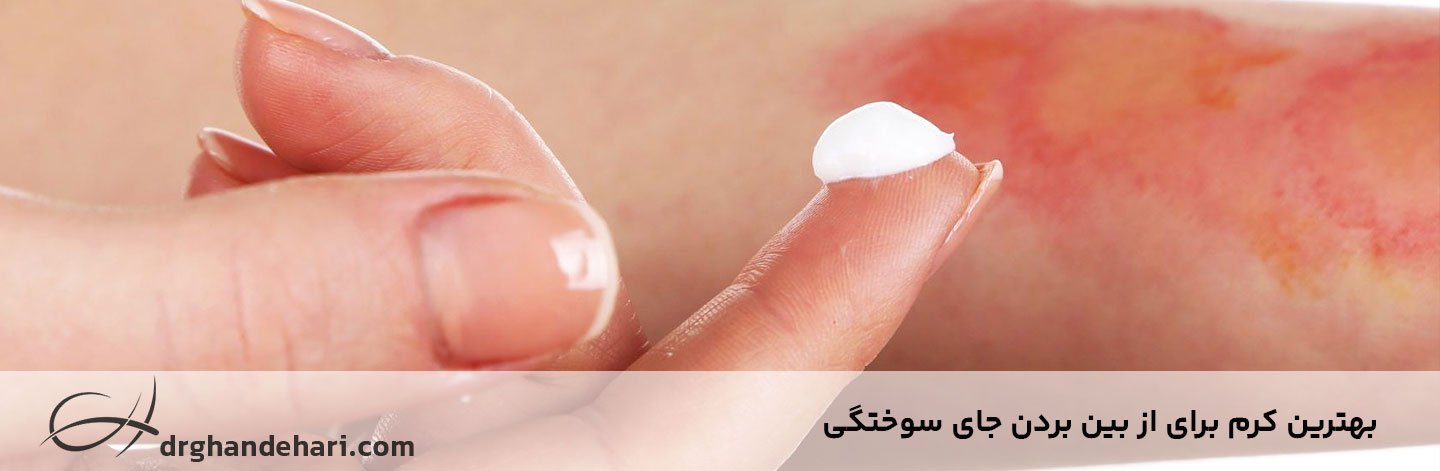 بهترین کرم برای از بین بردن جای سوختگی - پماد لک سوختگی قدیمی